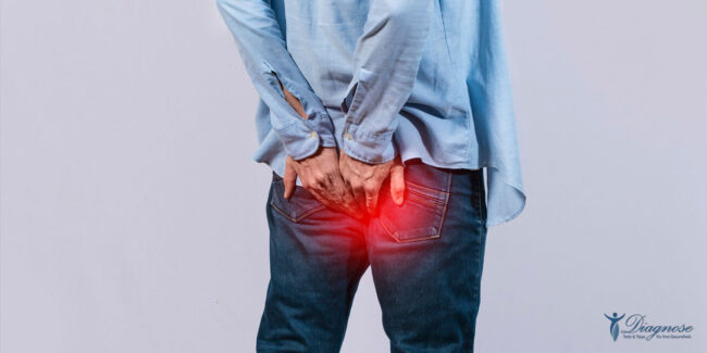 Hämorrhoiden Schweigen, leiden und nicht sitzen - das ist für viele Menschen, die an Hämorrhoiden leiden, oft das oberste tägliche Gebot.